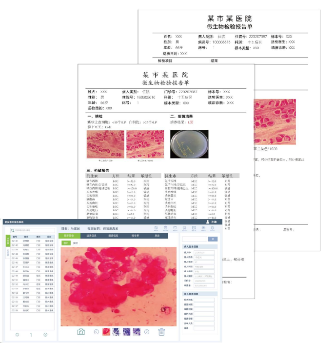 微生物图文报告<br>JEDU-IVD-5200系列