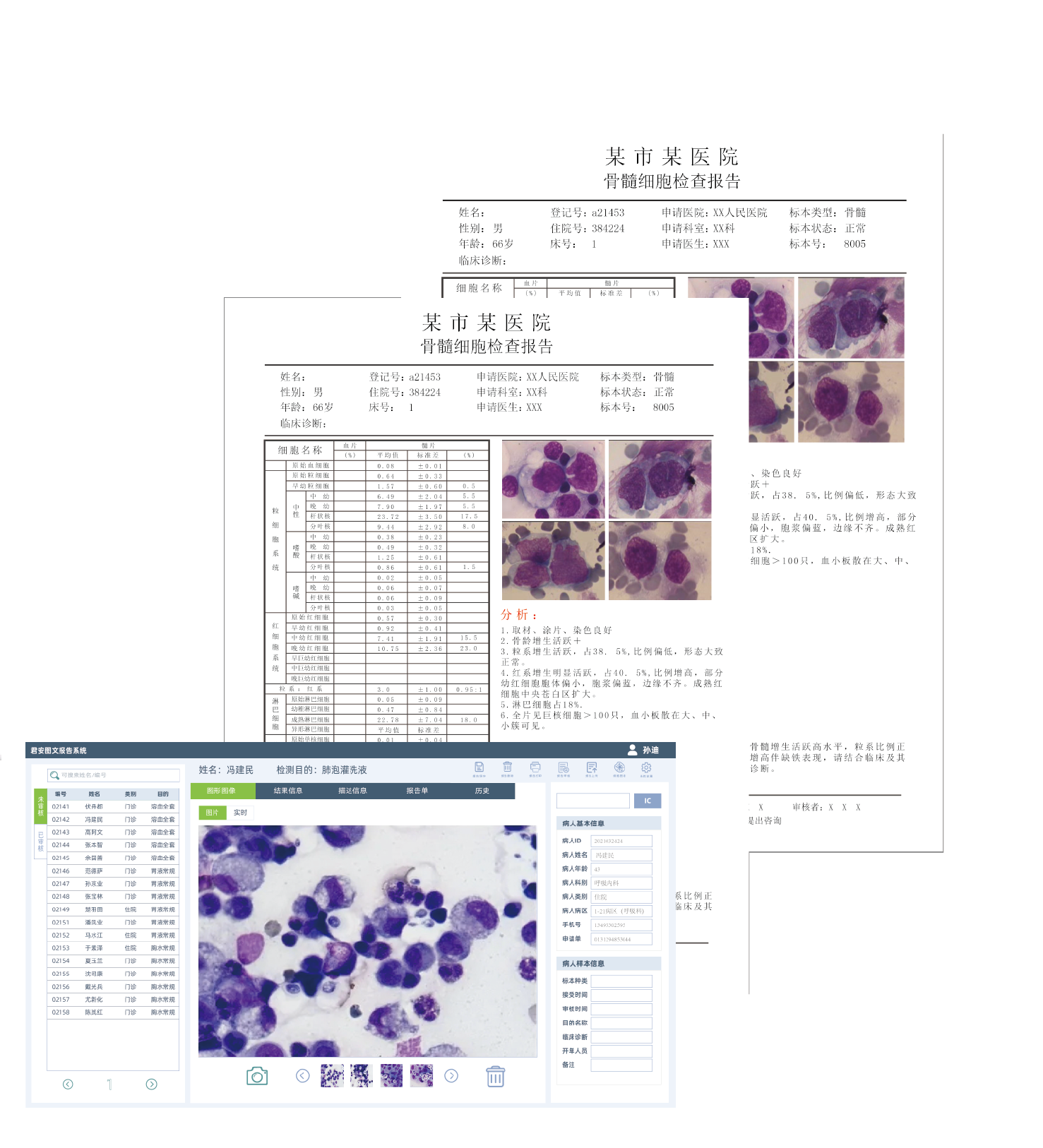 骨髓图文报告<br>JEDU-IVD-5100系列