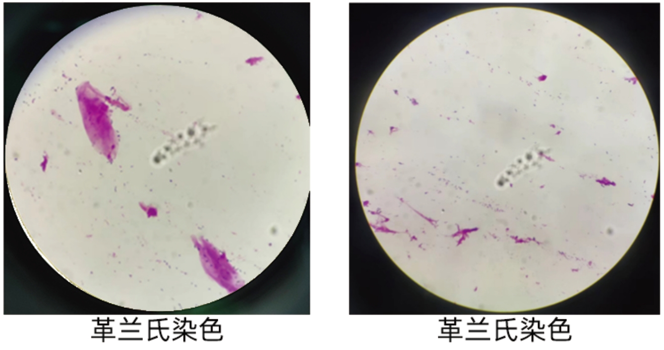 革兰氏染色02.png